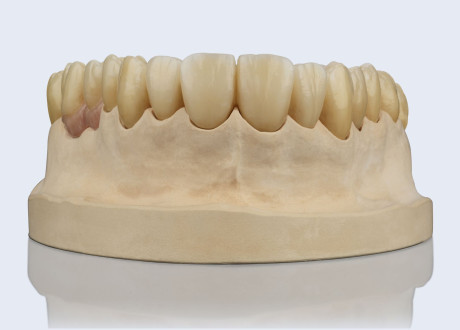 AG Showcase Ceramill D Wax 02